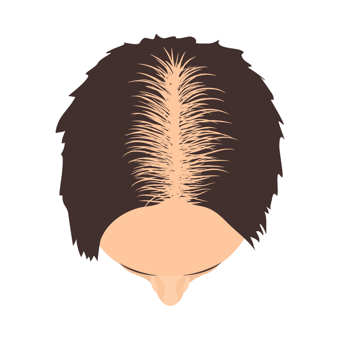hair