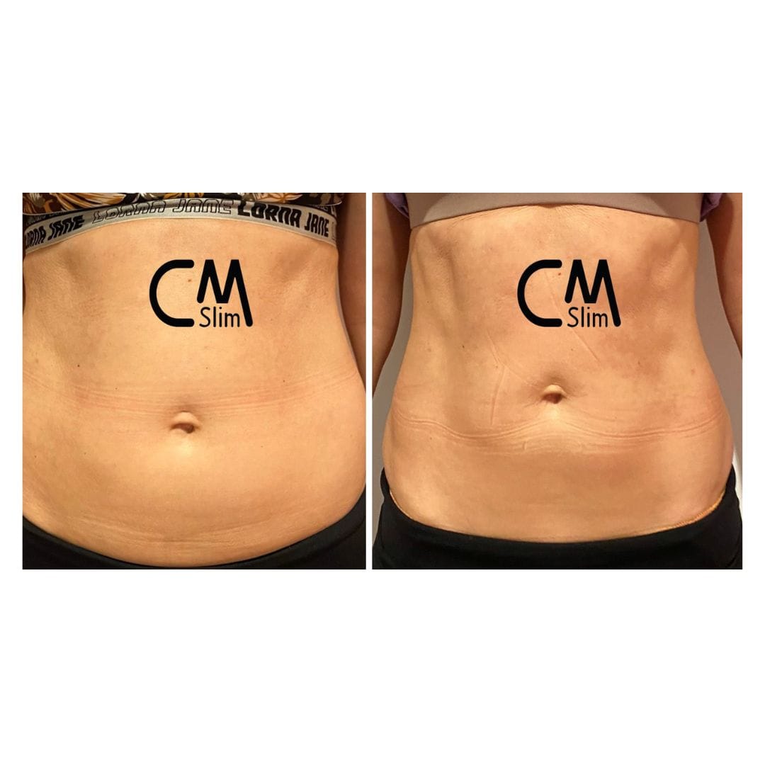 before after treatment