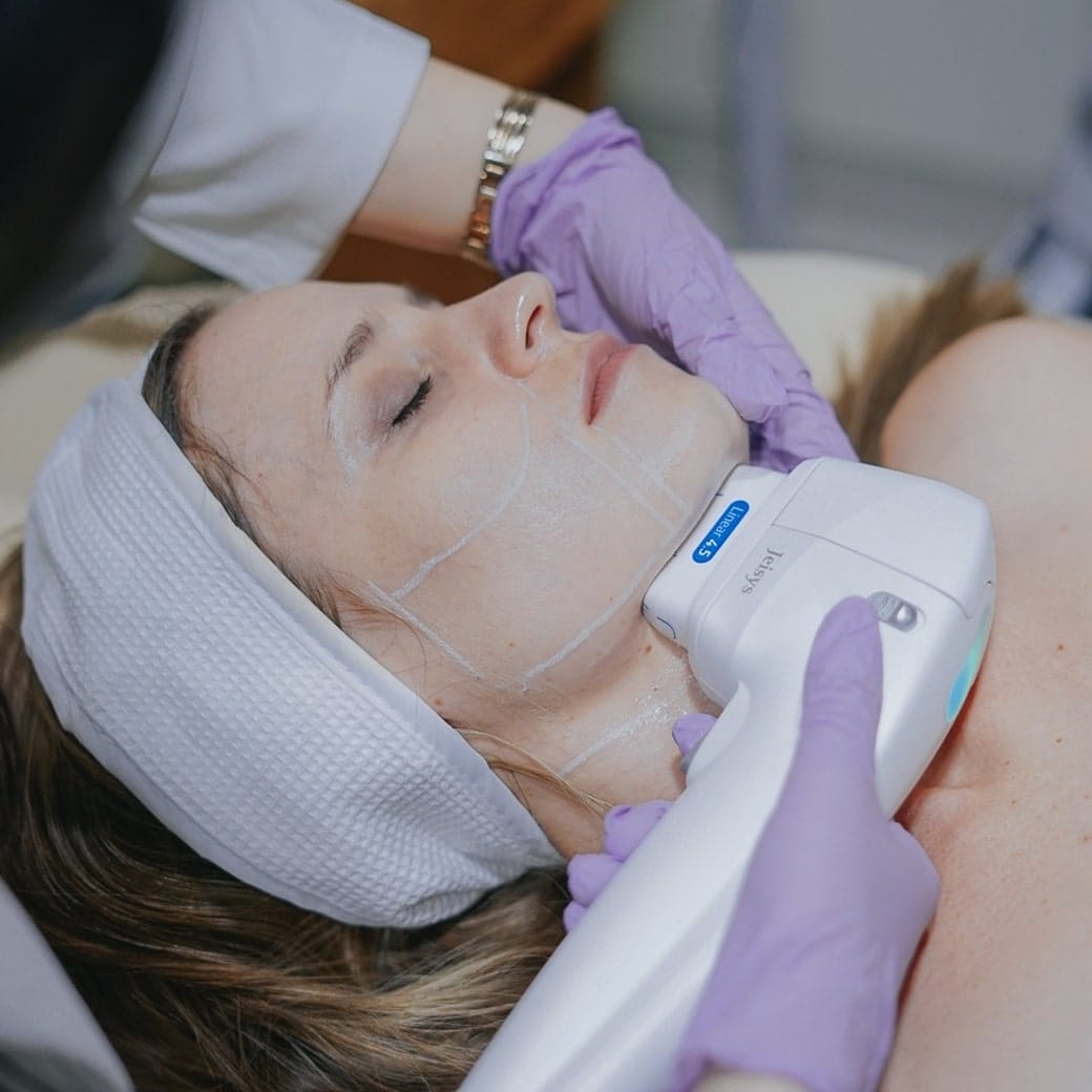 HIFU treatment