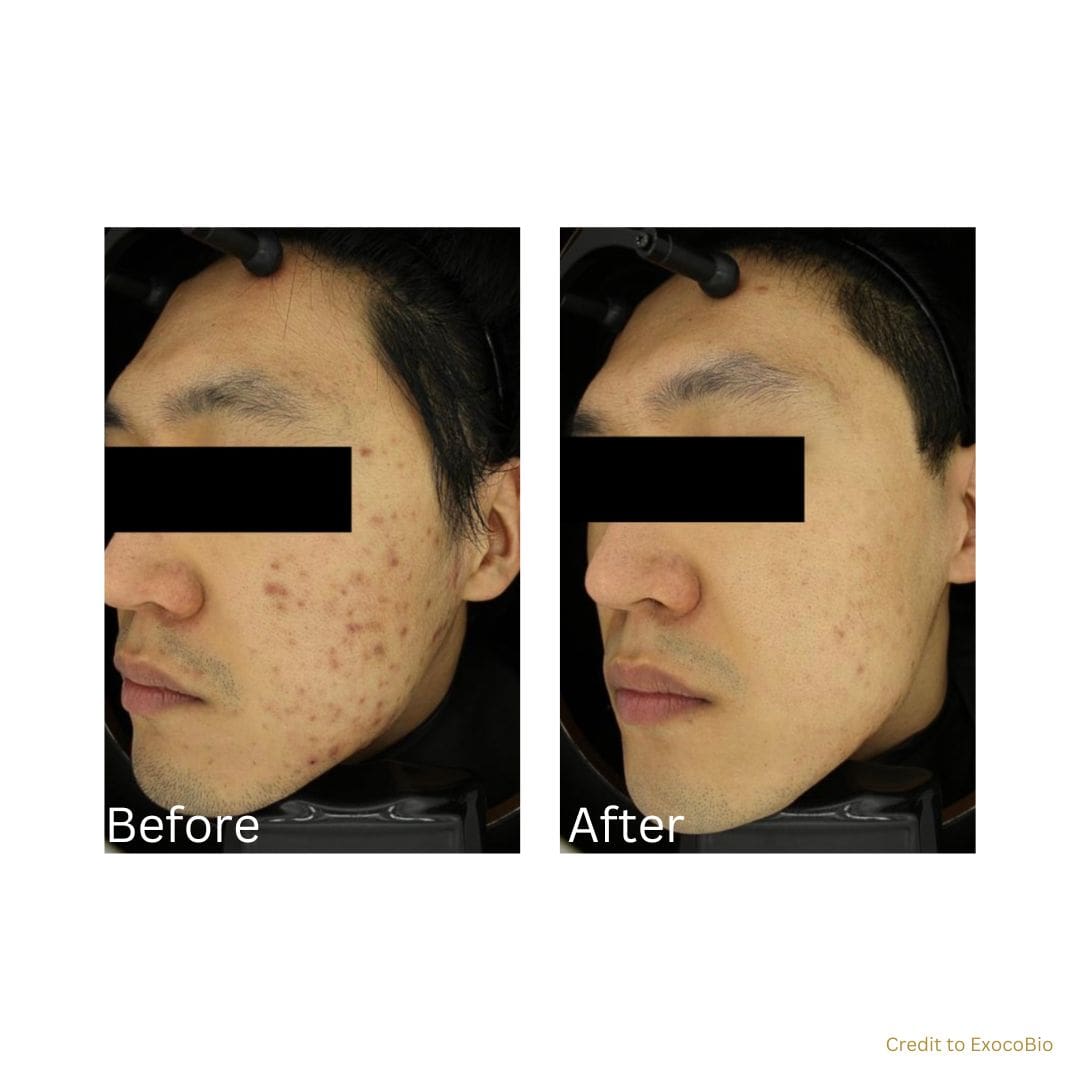 before after treatment