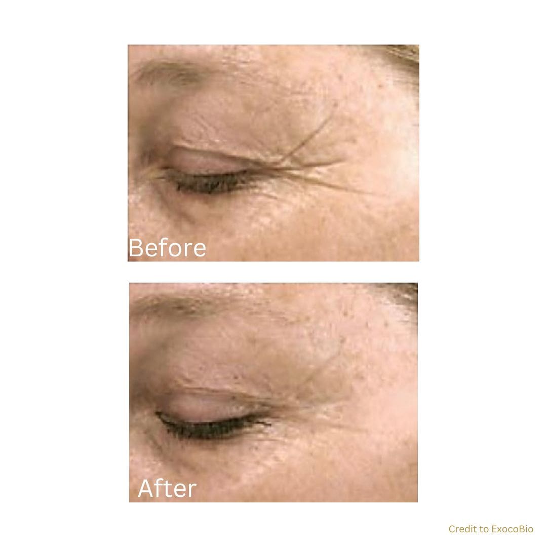 before after treatment
