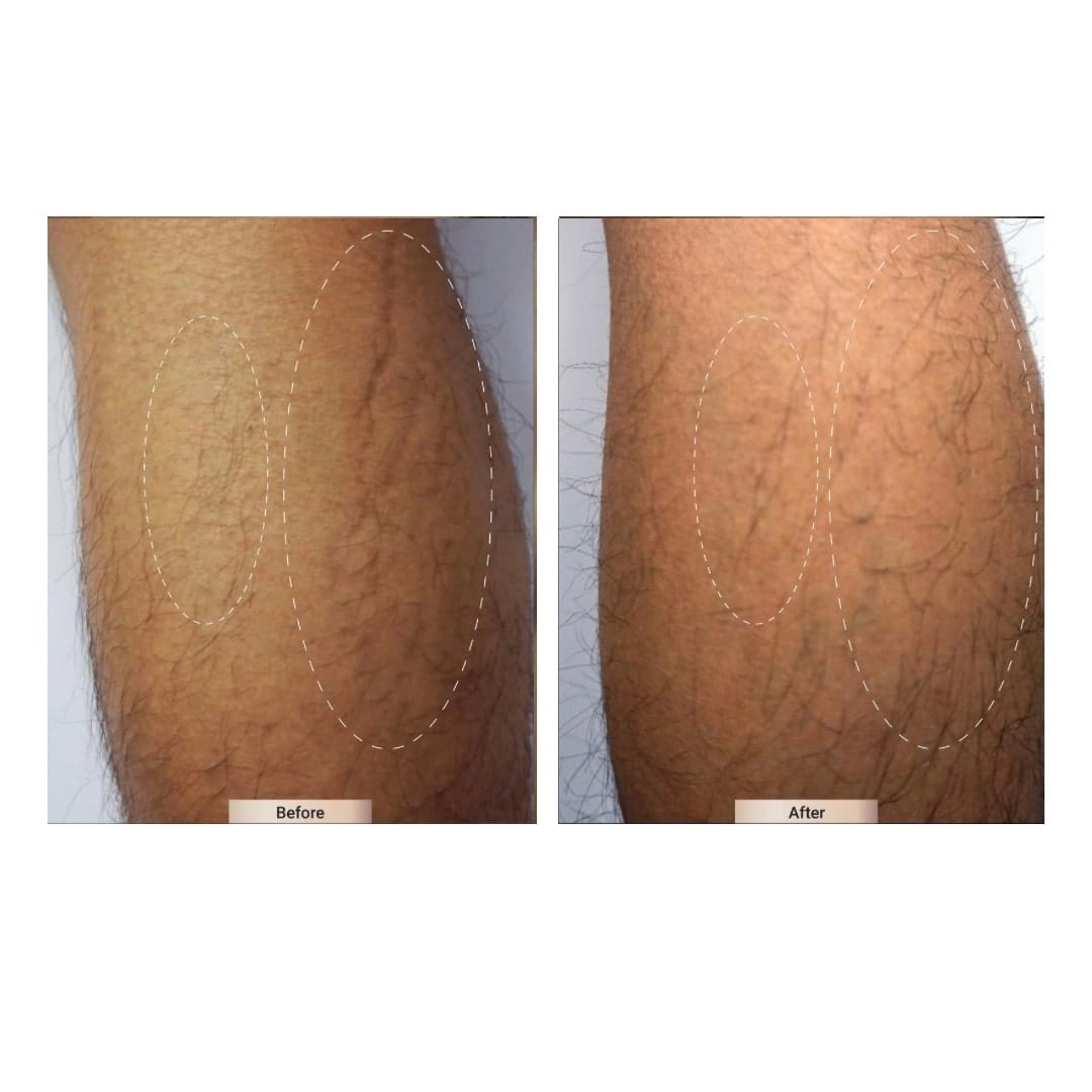 before after treatment
