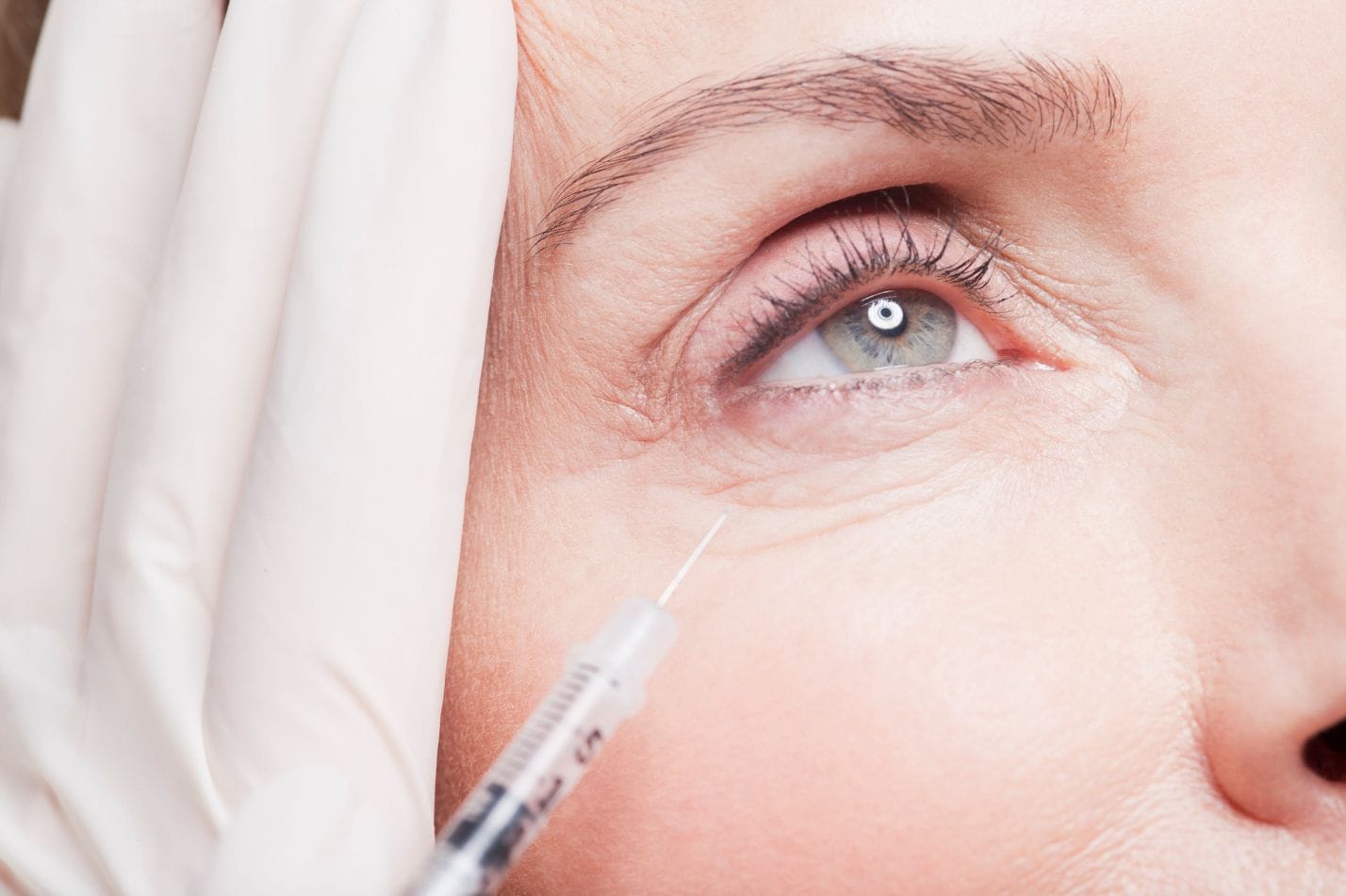 botox treatment