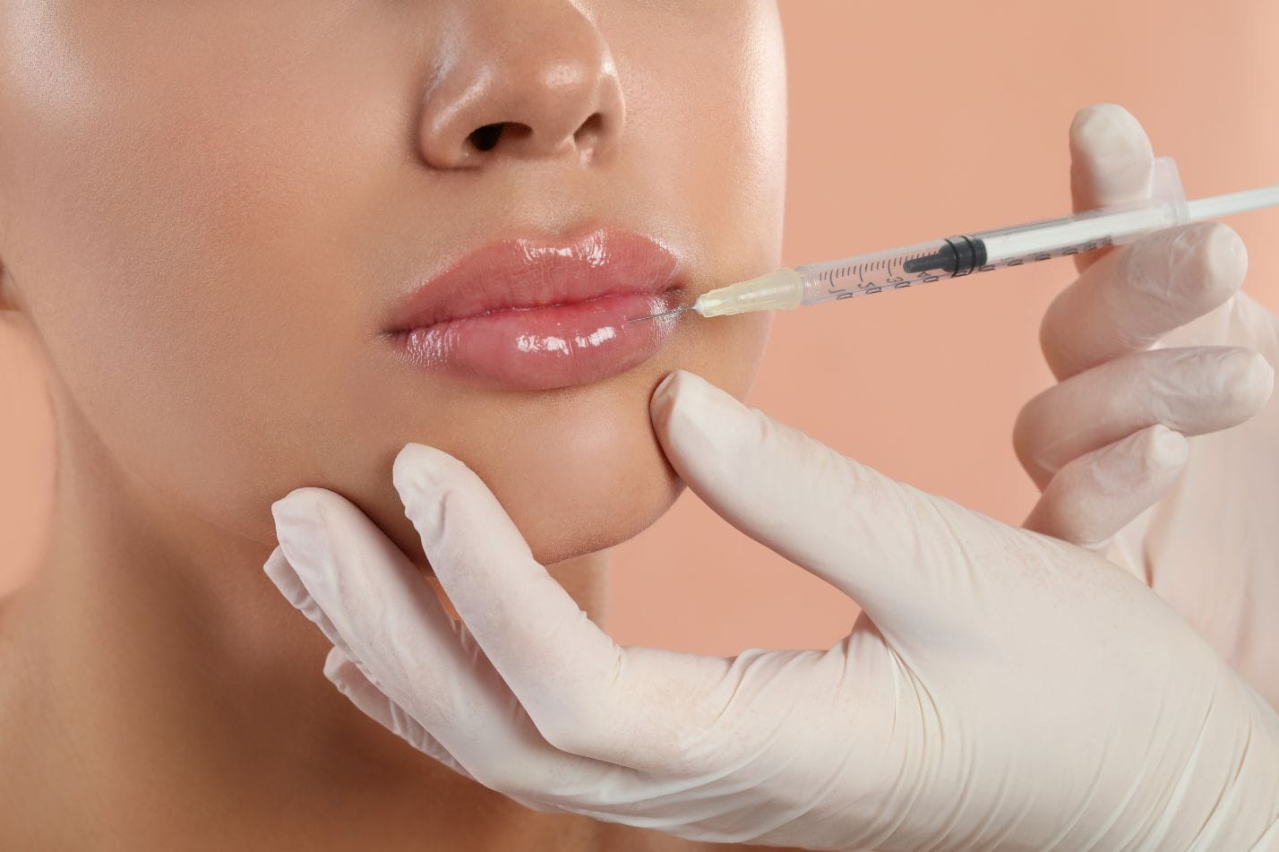lip filler treatment